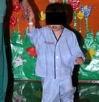 Tratamiento moderno del hipospadias imagen de doble pañal